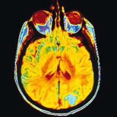 Application of Image Processing in Medicine (tumor with MATLAB)