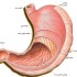 مقاله بیماری های معده و دئودنوم